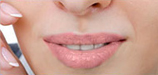 Chirurgia estetica delle labbra, Dr. Abenavoli
